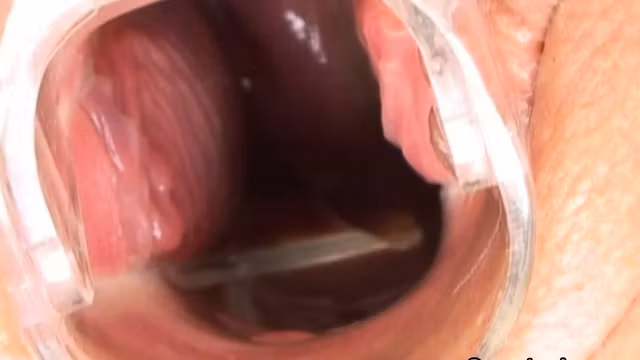 Deepthroat teen gapes hole with speculum