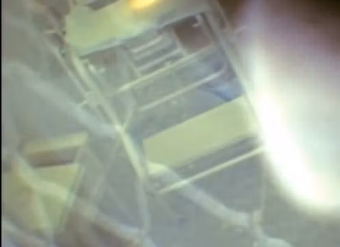 Hidden shooting nude woman in the medical office